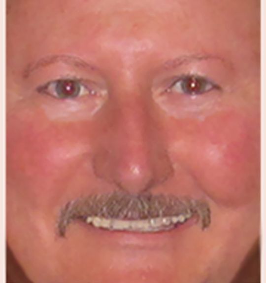 Dennis Niec